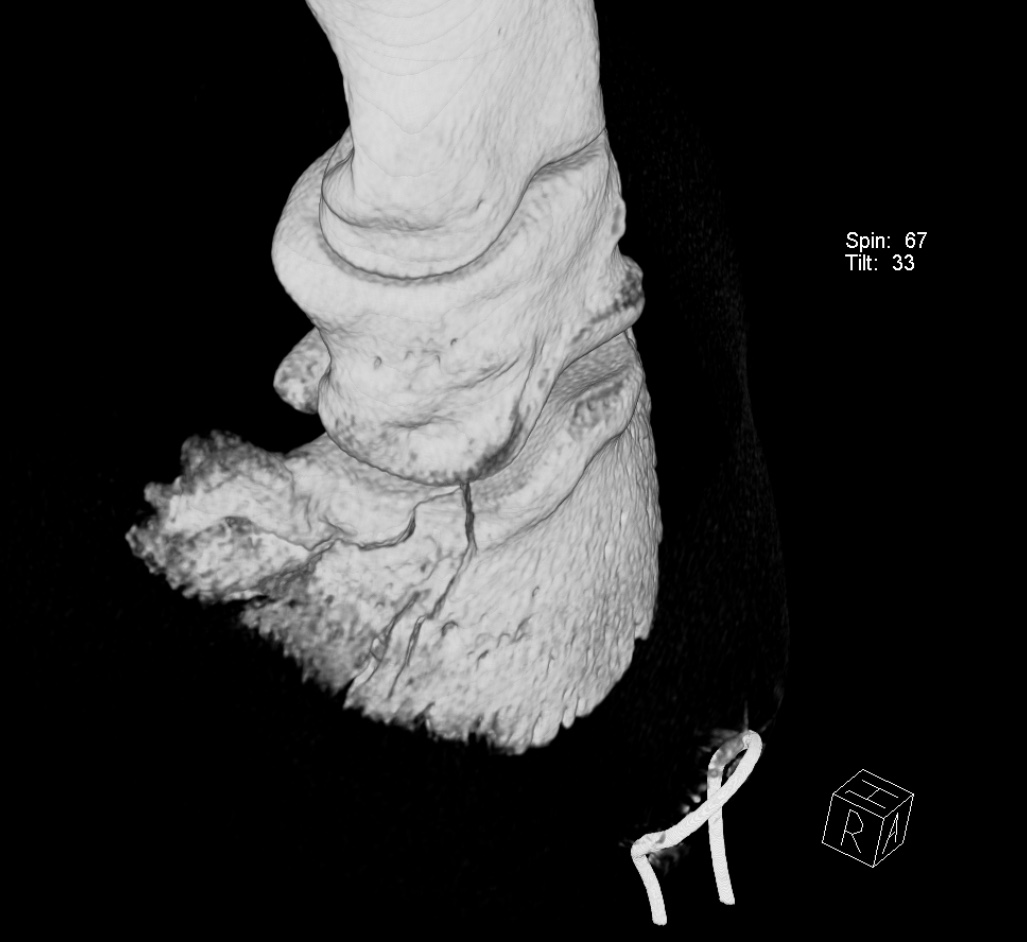 3D Rekonstruktions CT-Bild, welches einen Hufbeinastbruch zeigt.