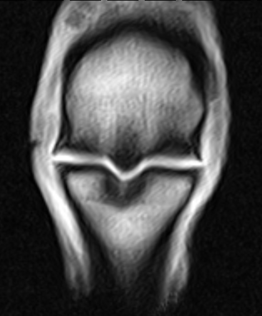 MRI-Bild