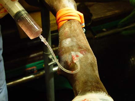 Das Bild zeigt eine intravenöse Antibiotika Perfusion im Bereich des Fessels. Mit einem Stauschlauch wird die Fesselregion von der ganzen Blutzirkulation abgesondert und das verdünnte Antibiotika wird mit einer speziellen Nadel in den angestauten Bereich gespritzt, damit es in diesem Bereich in einer hohen Konzentration wirken kann.