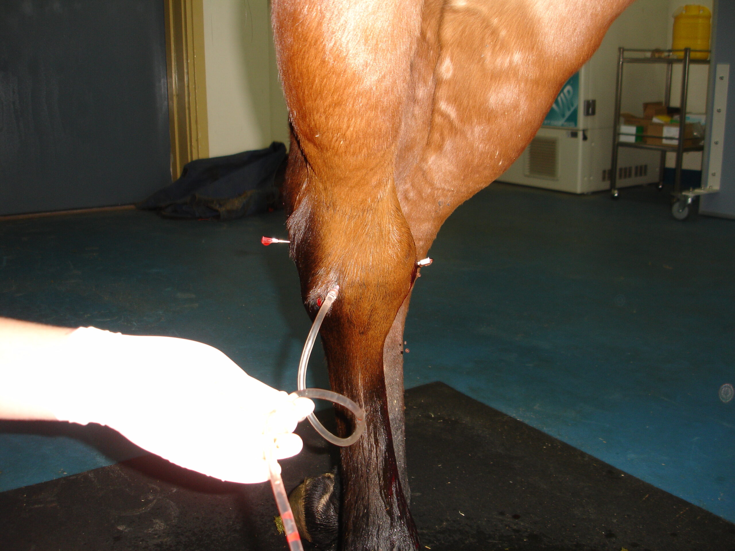 Eine frische Stichverletzung wird unter Sedation versorgt. Das Sprunggelenk wird über mehrere grosse Nadeln gespült.