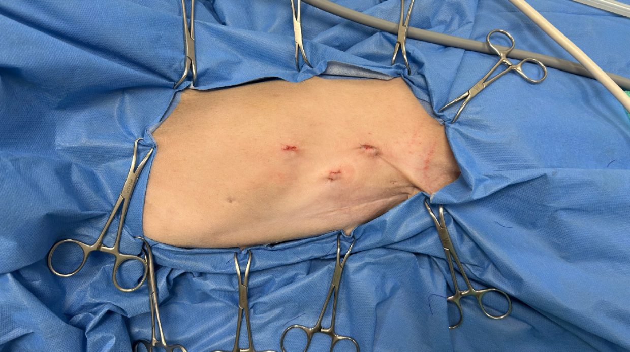 Operationsnarben am Bauch eines Hundes nach Laparoskopie